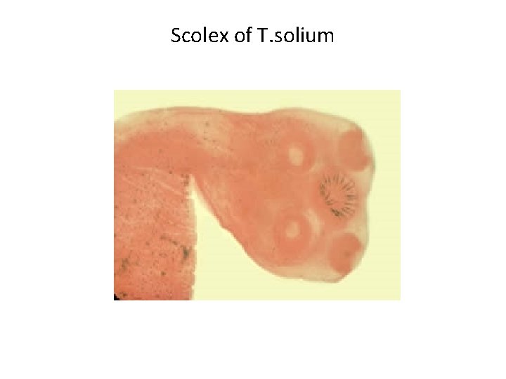 Scolex of T. solium 