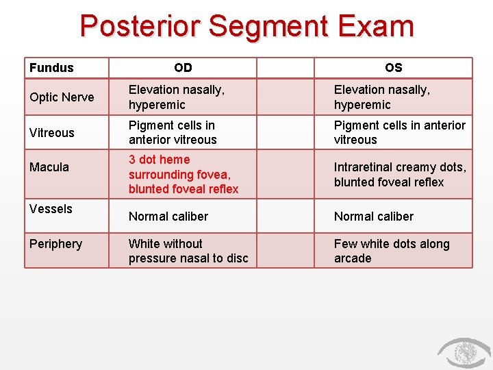 Posterior Segment Exam Fundus OD OS Optic Nerve Elevation nasally, hyperemic Vitreous Pigment cells