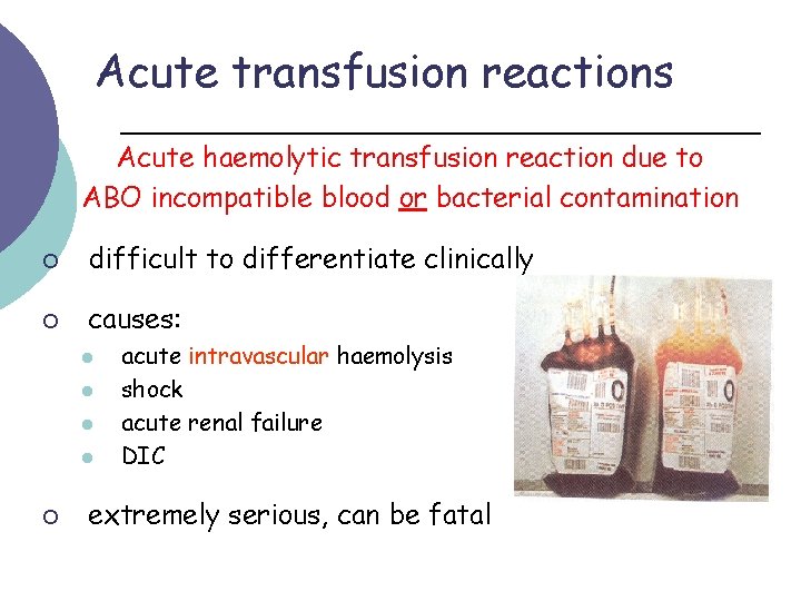 Acute transfusion reactions Acute haemolytic transfusion reaction due to ABO incompatible blood or bacterial