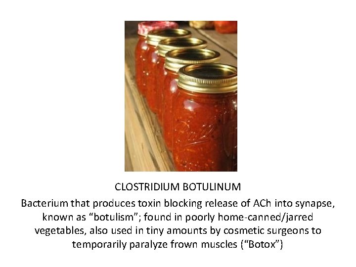 CLOSTRIDIUM BOTULINUM Bacterium that produces toxin blocking release of ACh into synapse, known as