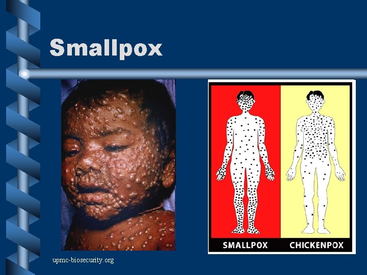 Smallpox upmc-biosecurity. org 