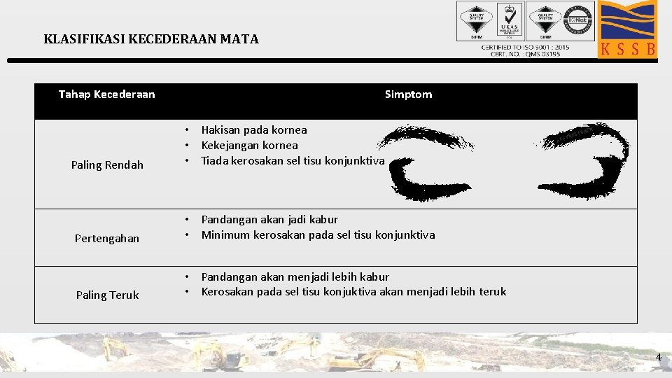 KLASIFIKASI KECEDERAAN MATA Tahap Kecederaan Simptom Paling Rendah • Hakisan pada kornea • Kekejangan