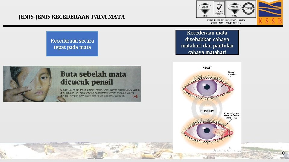 JENIS-JENIS KECEDERAAN PADA MATA Kecederaan secara tepat pada mata Kecederaan mata disebabkan cahaya matahari