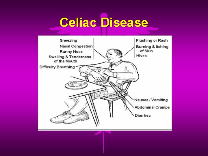 Celiac Disease 