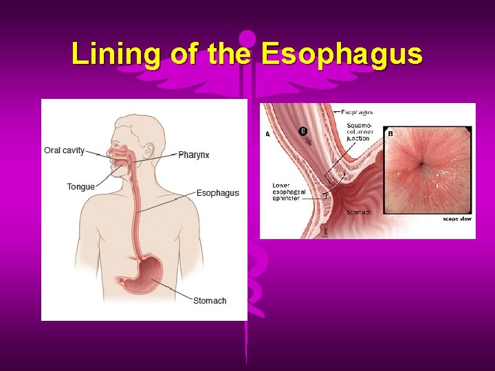 Lining of the Esophagus 