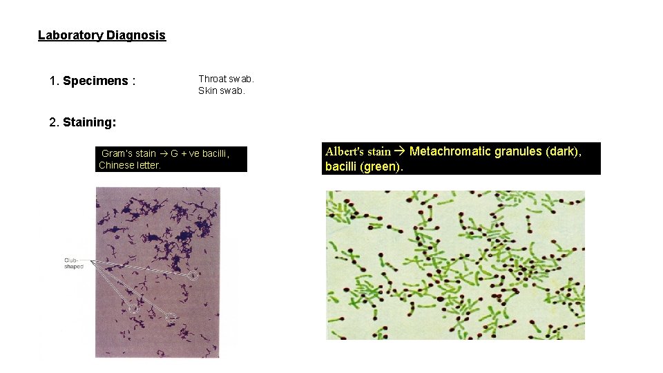 Laboratory Diagnosis 1. Specimens : Throat swab. Skin swab. 2. Staining: Gram’s stain G