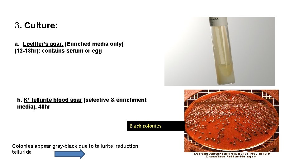 3. Culture: a. Loeffler’s agar. (Enriched media only) (12 -18 hr): contains serum or