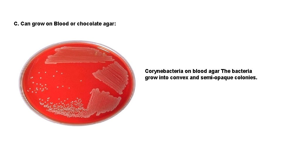 C. Can grow on Blood or chocolate agar: Corynebacteria on blood agar The bacteria