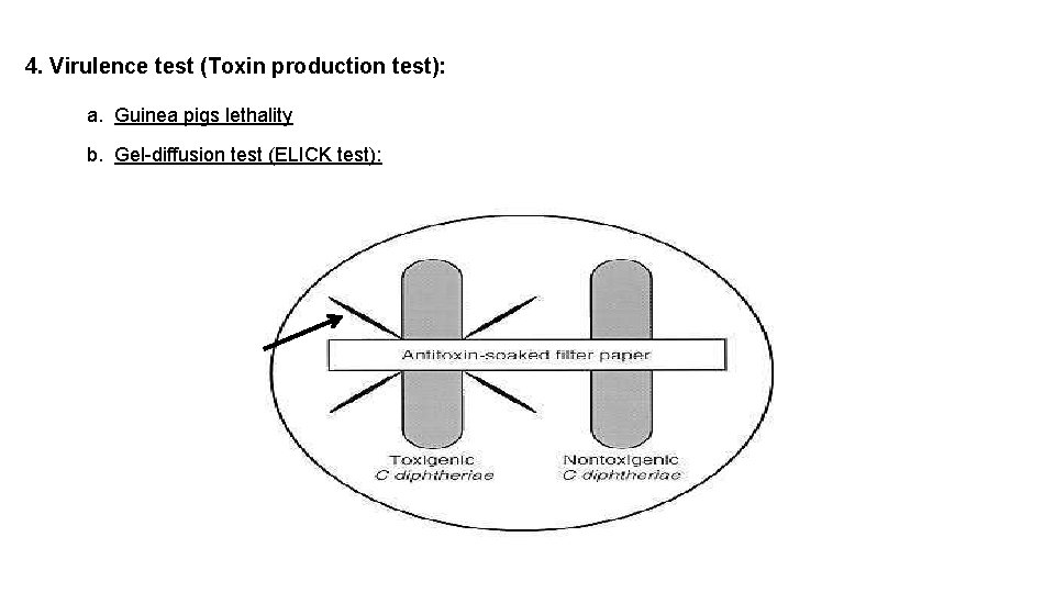 4. Virulence test (Toxin production test): a. Guinea pigs lethality b. Gel-diffusion test (ELICK
