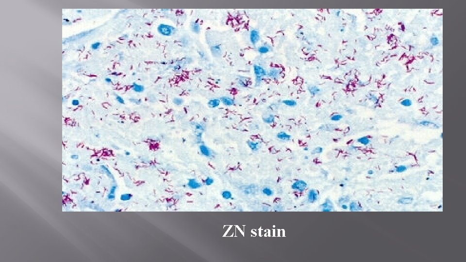 ZN stain 