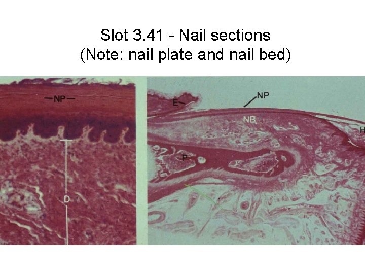 Slot 3. 41 - Nail sections (Note: nail plate and nail bed) 