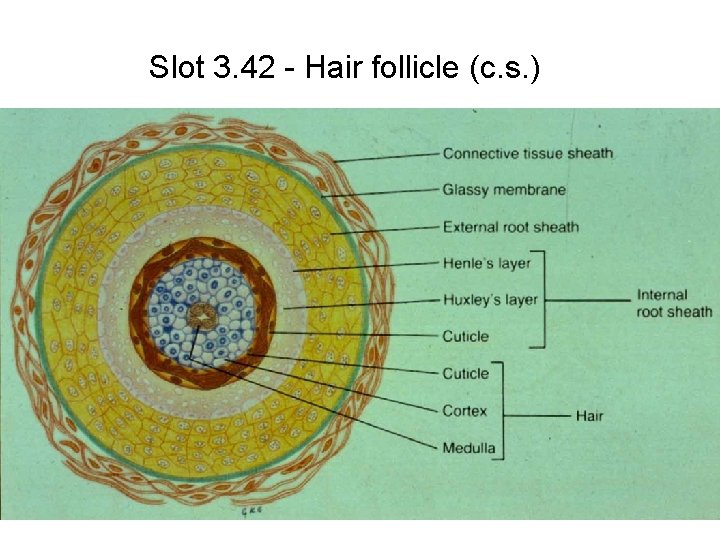 Slot 3. 42 - Hair follicle (c. s. ) 