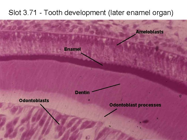 Slot 3. 71 - Tooth development (later enamel organ) Ameloblasts Enamel Dentin Odontoblasts Odontoblast