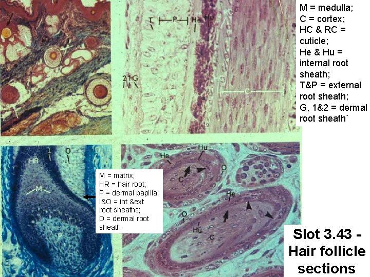 M = medulla; C = cortex; HC & RC = cuticle; He & Hu