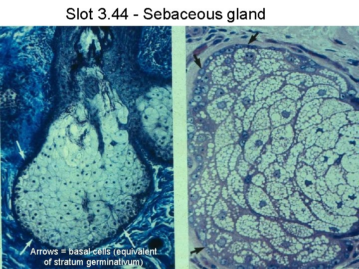 Slot 3. 44 - Sebaceous gland Arrows = basal cells (equivalent of stratum germinativum)