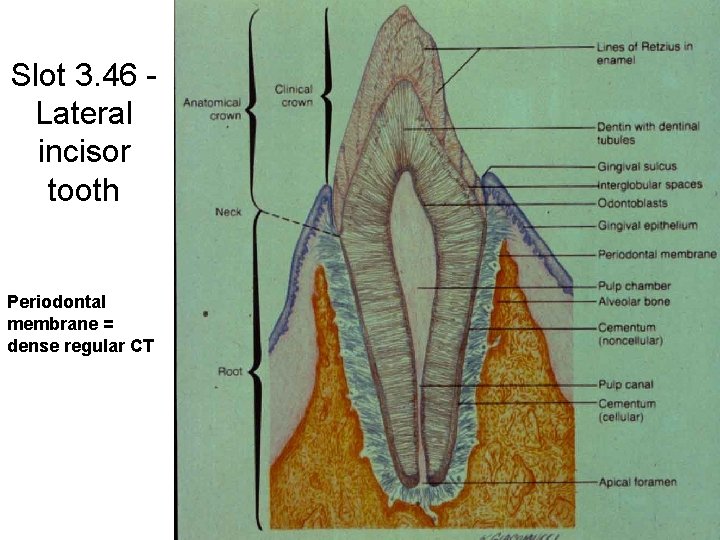 Slot 3. 46 Lateral incisor tooth Periodontal membrane = dense regular CT 