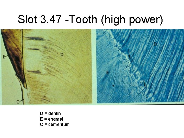 Slot 3. 47 -Tooth (high power) D = dentin E = enamel C =