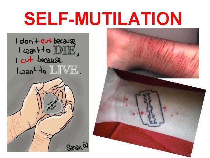 SELF-MUTILATION 