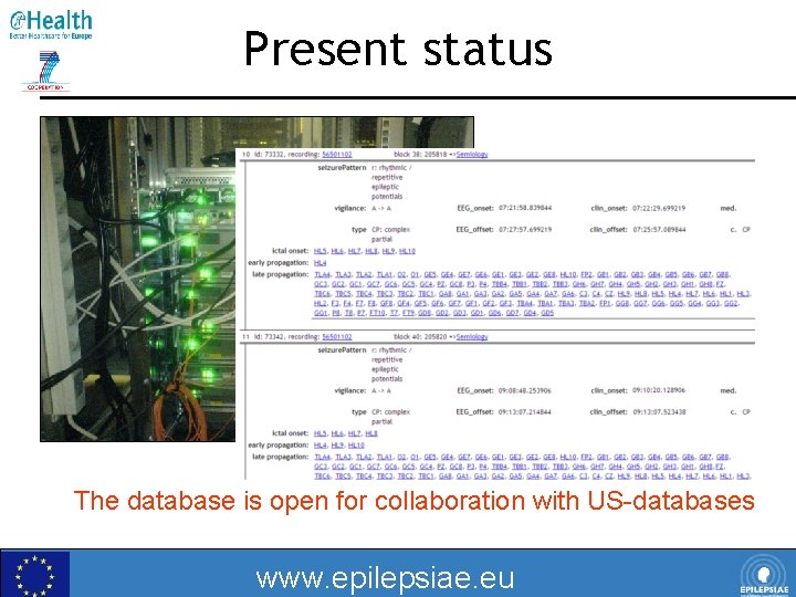Present status The database is open for collaboration with US-databases www. epilepsiae. eu 