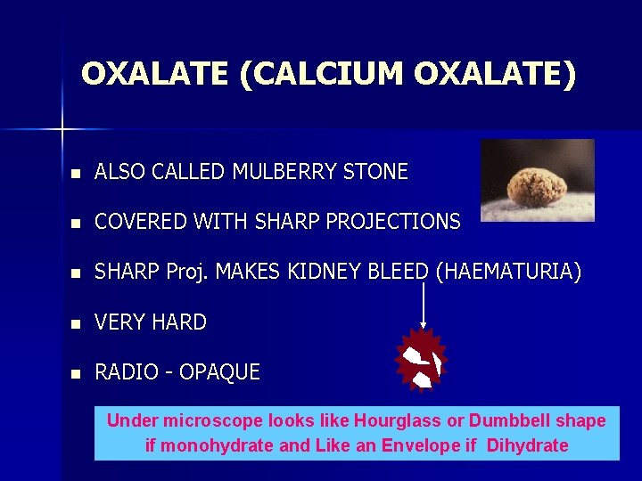 OXALATE (CALCIUM OXALATE) n ALSO CALLED MULBERRY STONE n COVERED WITH SHARP PROJECTIONS n