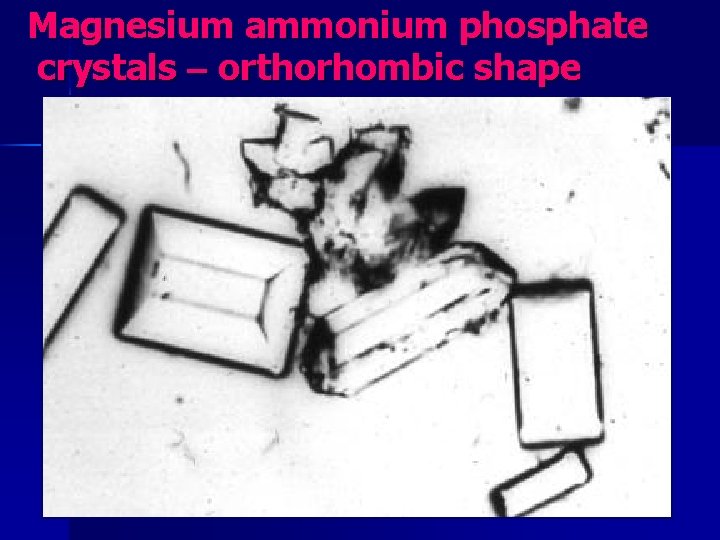 Magnesium ammonium phosphate crystals – orthorhombic shape 