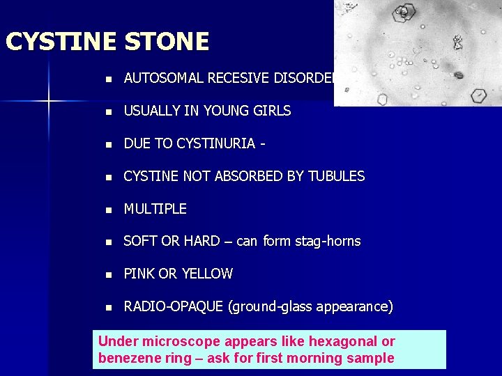 CYSTINE STONE n AUTOSOMAL RECESIVE DISORDER n USUALLY IN YOUNG GIRLS n DUE TO