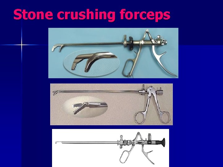 Stone crushing forceps 