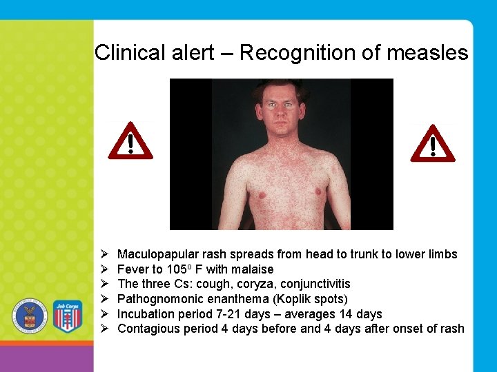 Clinical alert – Recognition of measles Ø Maculopapular rash spreads from head to trunk Clinical alert – Recognition of measles Ø Maculopapular rash spreads from head to trunk