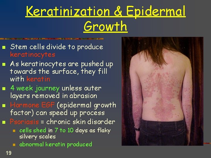 Keratinization & Epidermal Growth n n n Stem cells divide to produce keratinocytes As