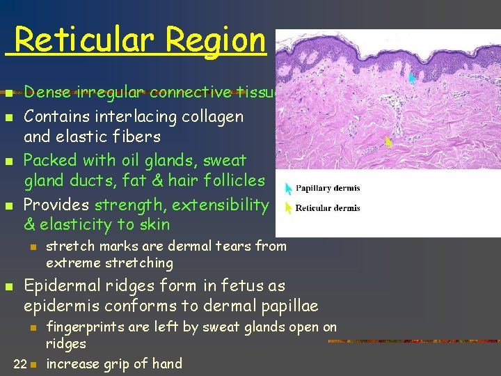 Reticular Region n n Dense irregular connective tissue Contains interlacing collagen and elastic fibers