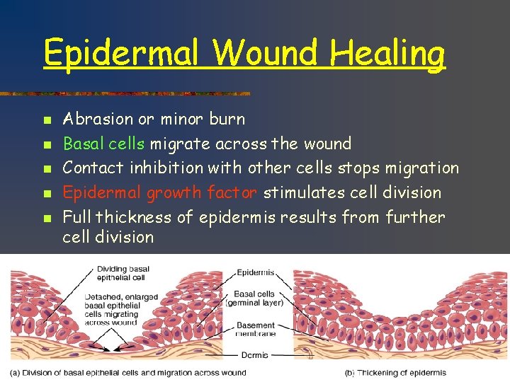 Epidermal Wound Healing n n n 37 Abrasion or minor burn Basal cells migrate