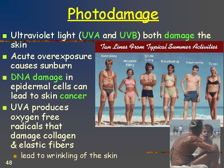 Photodamage n n Ultraviolet light (UVA and UVB) both damage the skin Acute overexposure