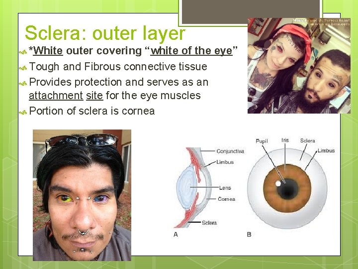 Sclera: outer layer *White outer covering “white of the eye” Tough and Fibrous connective