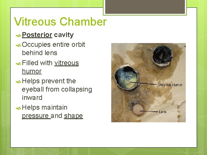 Vitreous Chamber Posterior cavity Occupies entire orbit behind lens Filled with vitreous humor Helps