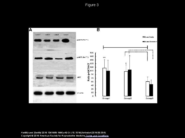 Figure 3 Fertility and Sterility 2016 1061658 -1665. e 4 DOI: (10. 1016/j. fertnstert.