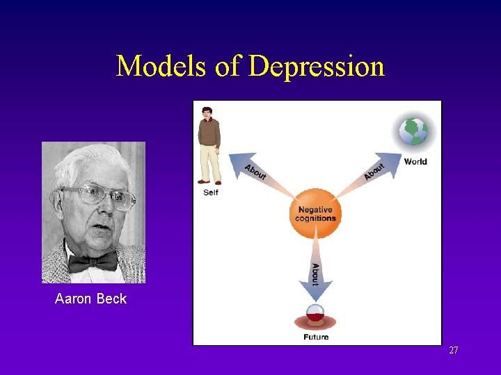 Models of Depression Aaron Beck 27 