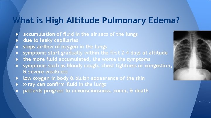 What is High Altitude Pulmonary Edema? accumulation of fluid in the air sacs of