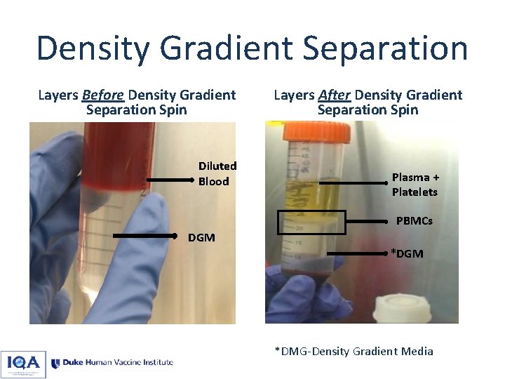 Density Gradient Separation Layers Before Density Gradient Separation Spin Diluted Blood Layers After Density