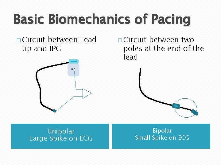 Basic Biomechanics of Pacing � Circuit between Lead tip and IPG � Circuit between
