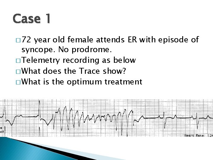Case 1 � 72 year old female attends ER with episode of syncope. No