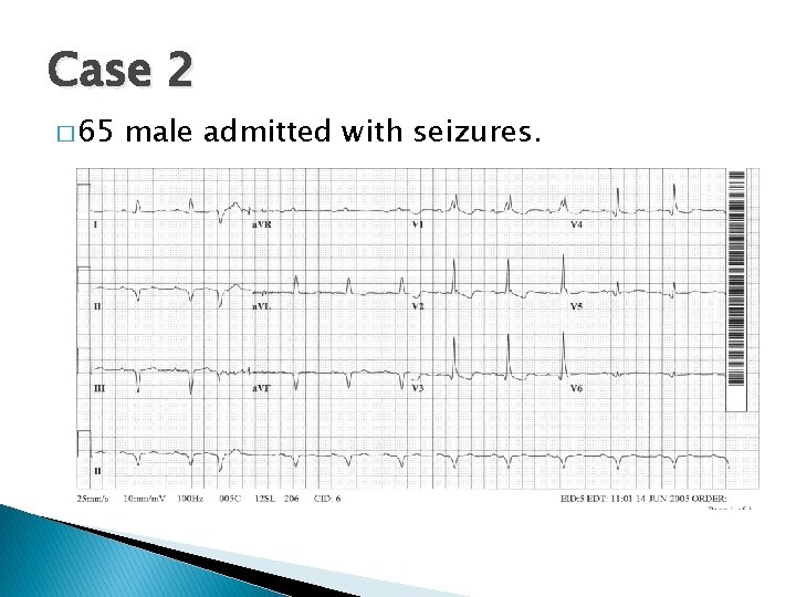 Case 2 � 65 male admitted with seizures. 