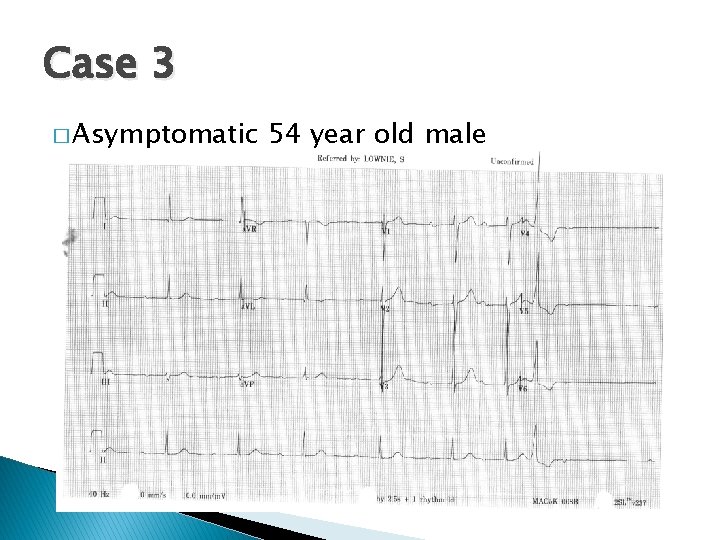 Case 3 � Asymptomatic 54 year old male 