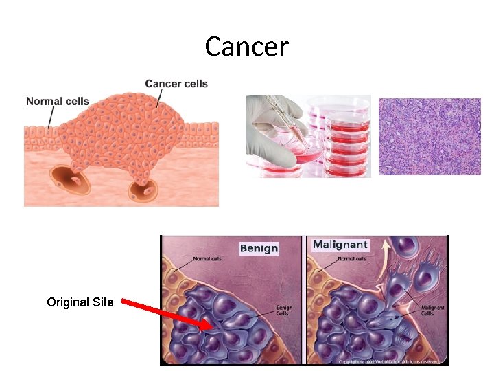 Cancer Original Site 