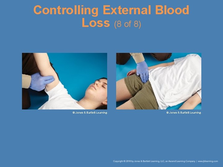 Controlling External Blood Loss (8 of 8) © Jones & Bartlett Learning. 