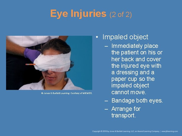 Eye Injuries (2 of 2) • Impaled object © Jones & Bartlett Learning. Courtesy