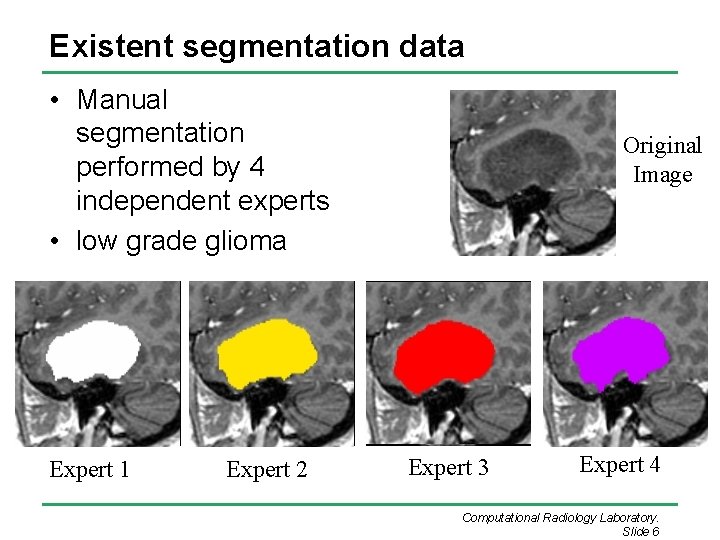 Existent segmentation data • Manual segmentation performed by 4 independent experts • low grade