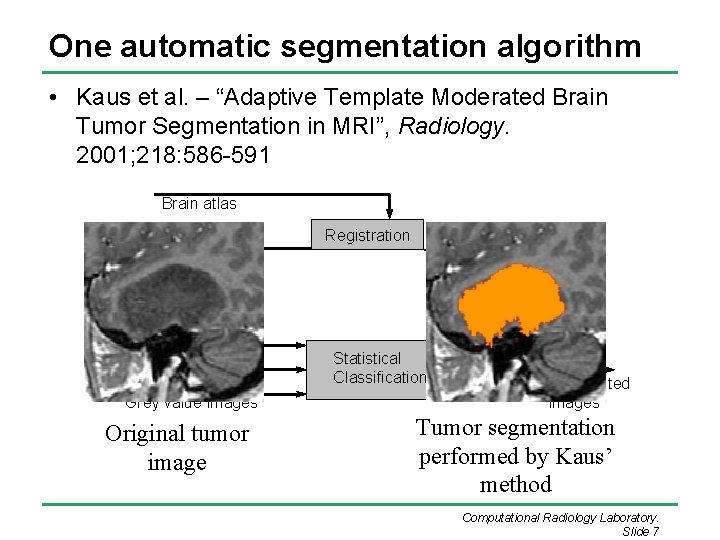 One automatic segmentation algorithm • Kaus et al. – “Adaptive Template Moderated Brain Tumor