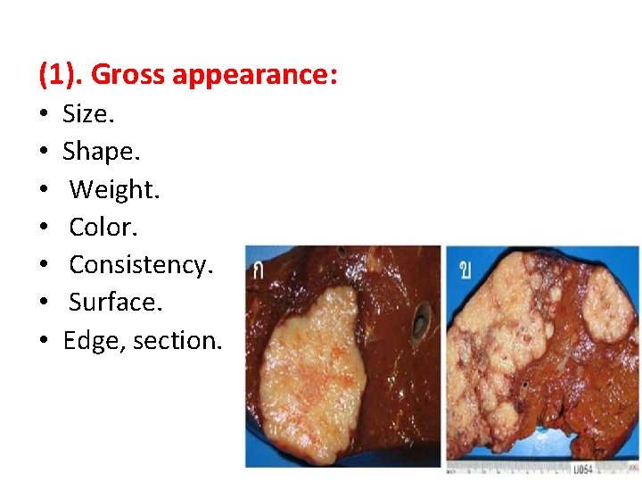 (1). Gross appearance: • • Size. Shape. Weight. Color. Consistency. Surface. Edge, section. 