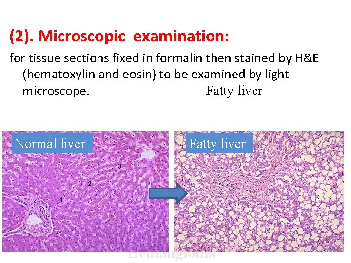 (2). Microscopic examination: for tissue sections fixed in formalin then stained by H&E (hematoxylin