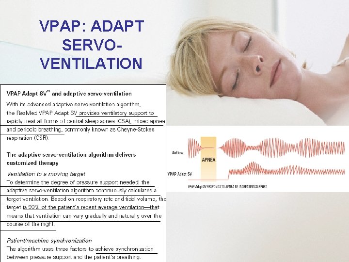 VPAP: ADAPT SERVOVENTILATION 